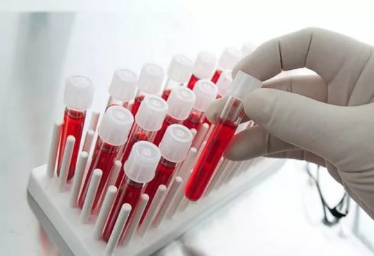 Анализ крови на гормоны - норма, расшифровка » Спортивный Мурманск