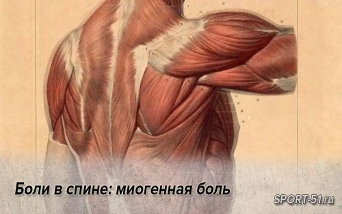 Боли в спине: миогенная боль